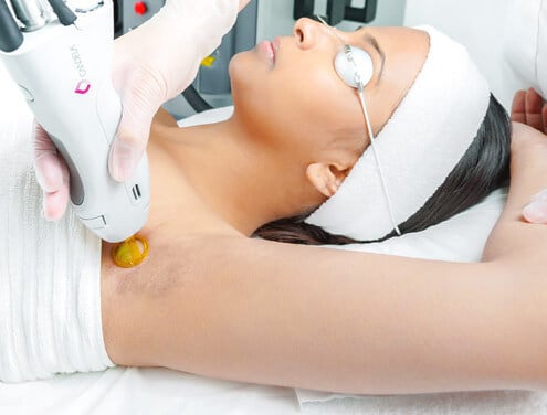 Laser hair removal | plastic surgery