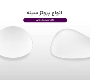 انواع پروتز سینه