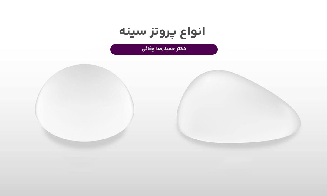 انواع پروتز سینه