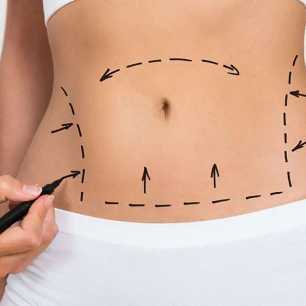 عمل پیکرتراشی پیکرتراشی